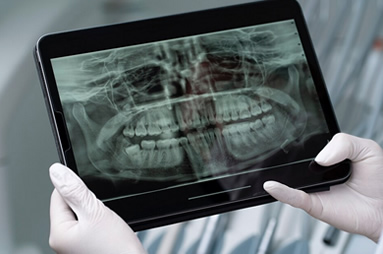 Inteligência artificial melhora qualidade de tomografias bucais