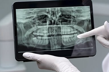 Radiografia Panorâmica Digital
